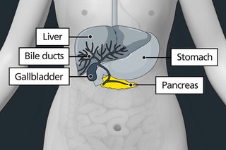 Diagram of the stomach area with labels showing the liver, stomach, gallbladder and pancreas. The pancreas is highlighted just below the stomach.