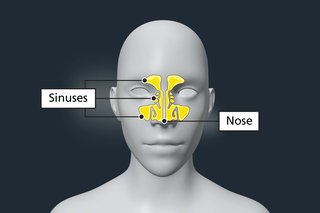 This is a medical illustration. It shows a frontal view of the human head, with labels pointing towards the nose and sinuses